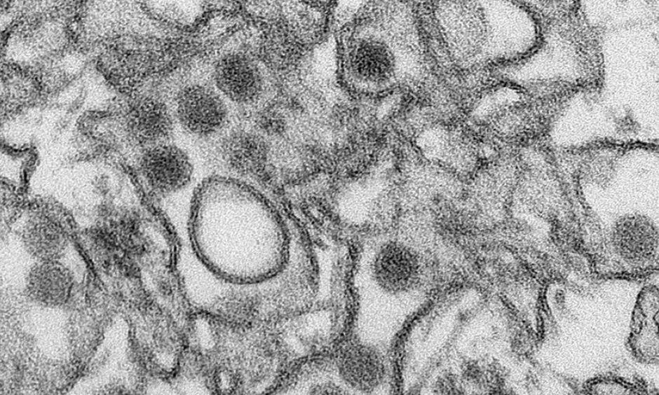 A transmission electron micrograph (TEM) shows the Zika virus, in an undated photo provided by the Centers For Disease Control in Atlanta, Georgia. Photo: Cynthia Goldsmith, Reuters, © CDC