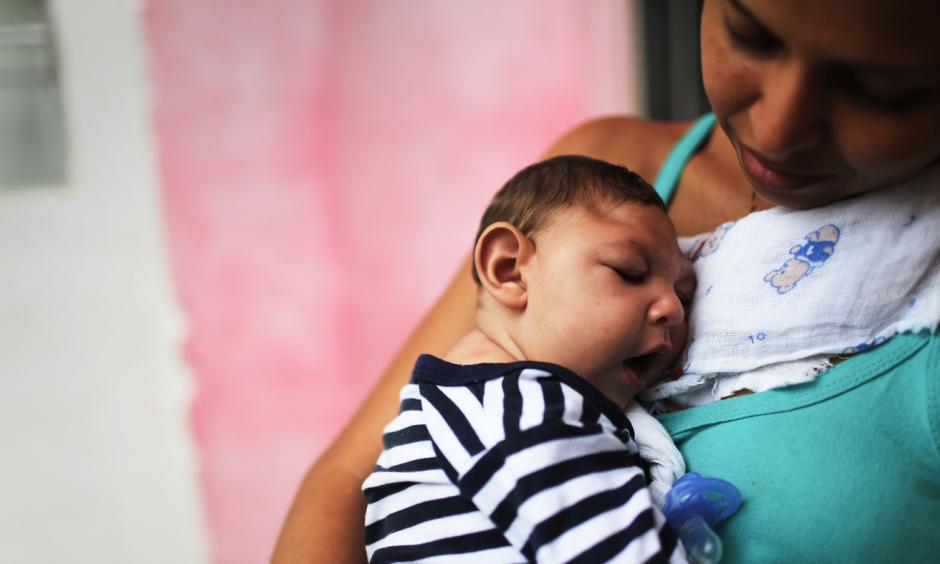 A mother holds her baby, who has microcephaly, in Recife, Brazil. Photo: Mario Tama, Getty Images
