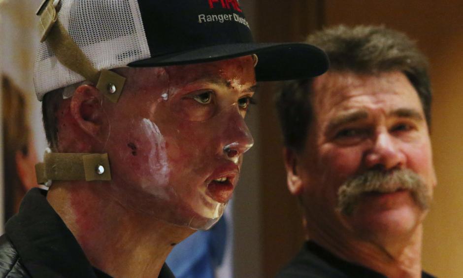 Daniel Lyon, Jr., the firefighter who survived the deadly Twisp blaze, speaks during a news conference at Harborview Medical Center on Wednesday in Seattle. At right is his father, Daniel Sr. (Ken Lambert / The Seattle Times)
