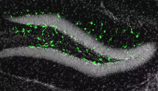 Zika in the adult brain: Illumination of the fluorescent biomarker in green revealed that Zika can infect the adult mouse brain in a region full of neural progenitor cells, which play an important role in learning and memory. Photo: Rockefeller Newswire