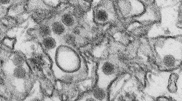 A transmission electron micrograph (TEM) shows the Zika virus, in an undated photo provided by the Centers For Disease Control in Atlanta, Georgia. Photo: Cynthia Goldsmith, Reuters, © CDC