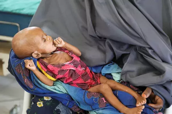 A Somali woman holds her malnourished child inside the pediatric ward at the Baradere Hospital after fleeing from drought hit settlements near Baradere town, Gedo Region, Jubaland state, Somalia, March 13, 2022. (Credit: REUTERS/Feisal Omar)