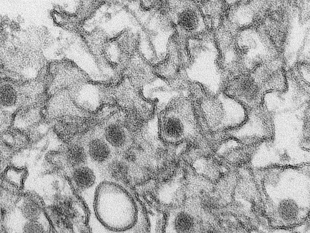 Transmission electron micrograph of Zika virus. Photo: U.S. Centers for Disease Control and Prevention